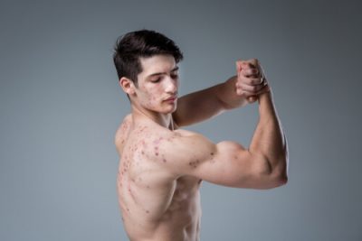 I 10 elementi chiave della bodybuilder prima e dopo steroidi